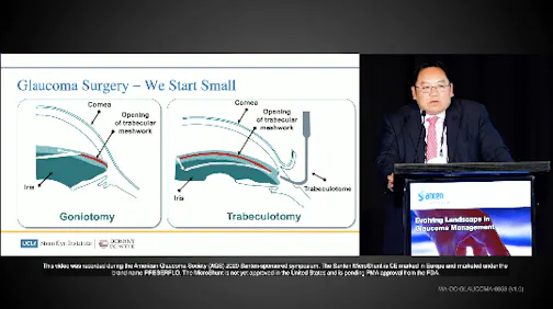 Glaucoma Procedures—From Small to Large