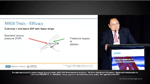 Glaucoma Procedure Efficacy