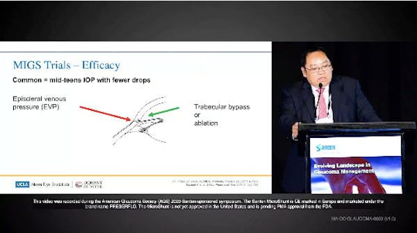 Glaucoma Procedure Efficacy thumbnail