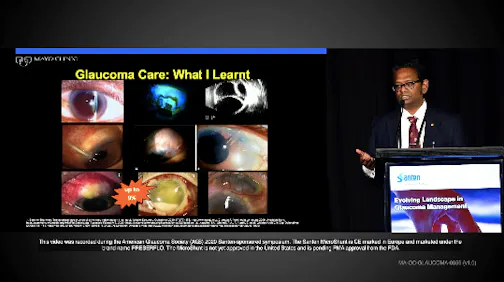 Glaucoma Treatment Decisions
