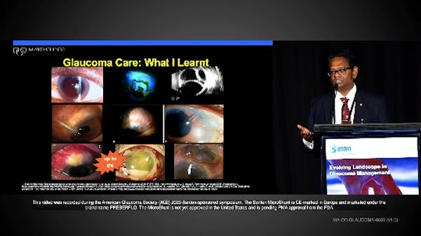 Glaucoma Treatment Decisions thumbnail