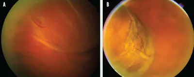 Retina Then and Now: January/February Spotlight image