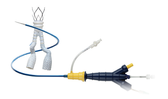Innovations - Endovascular Today