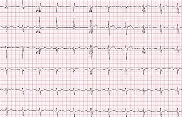 Challenge Case Report: Left-Sided Headache & Dizziness - Practical ...