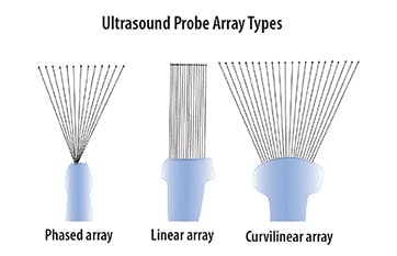 curvilinear probe ultrasound pediatric