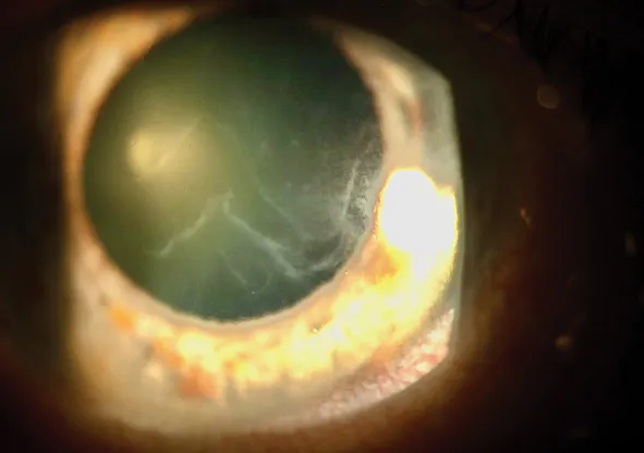 EBMD: Part 1 - Modern Optometry