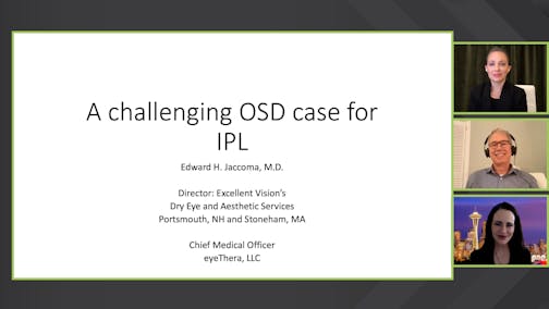 A Challenging Case for IPL