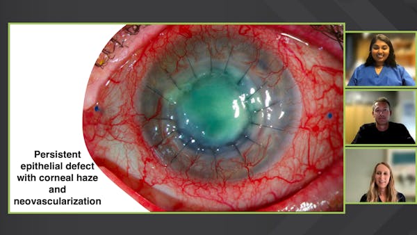 When the Epithelium Doesn't Like You thumbnail