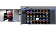 Using multi-modality in ZEISS Retina Workplace: A case of Neovascular AMD