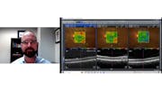 ZEISS Retina Workflow: How to use multi-modal imaging for Diabetic Retinopathy