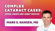 Complex Cataract Cases: Dense Lenses and Assist Devices