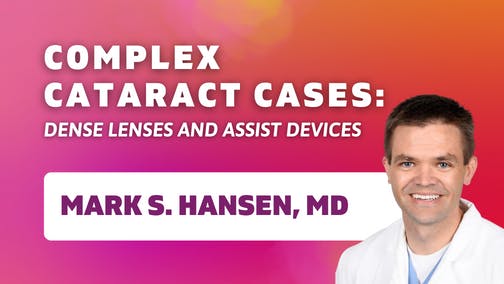 Complex Cataract Cases: Dense Lenses and Assist Devices