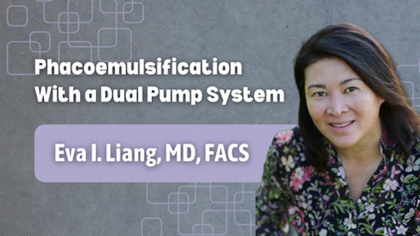 Phacoemulsification With a Dual Pump System thumbnail