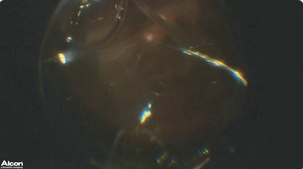 Air/Fluid Exchange thumbnail