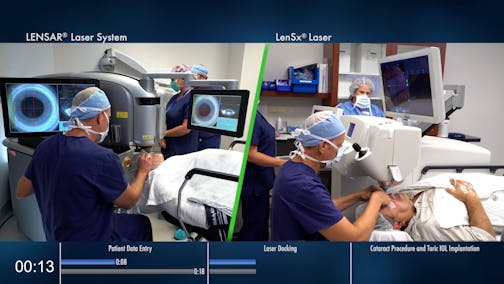 LENSAR Laser with Upgraded Streamline IV Software