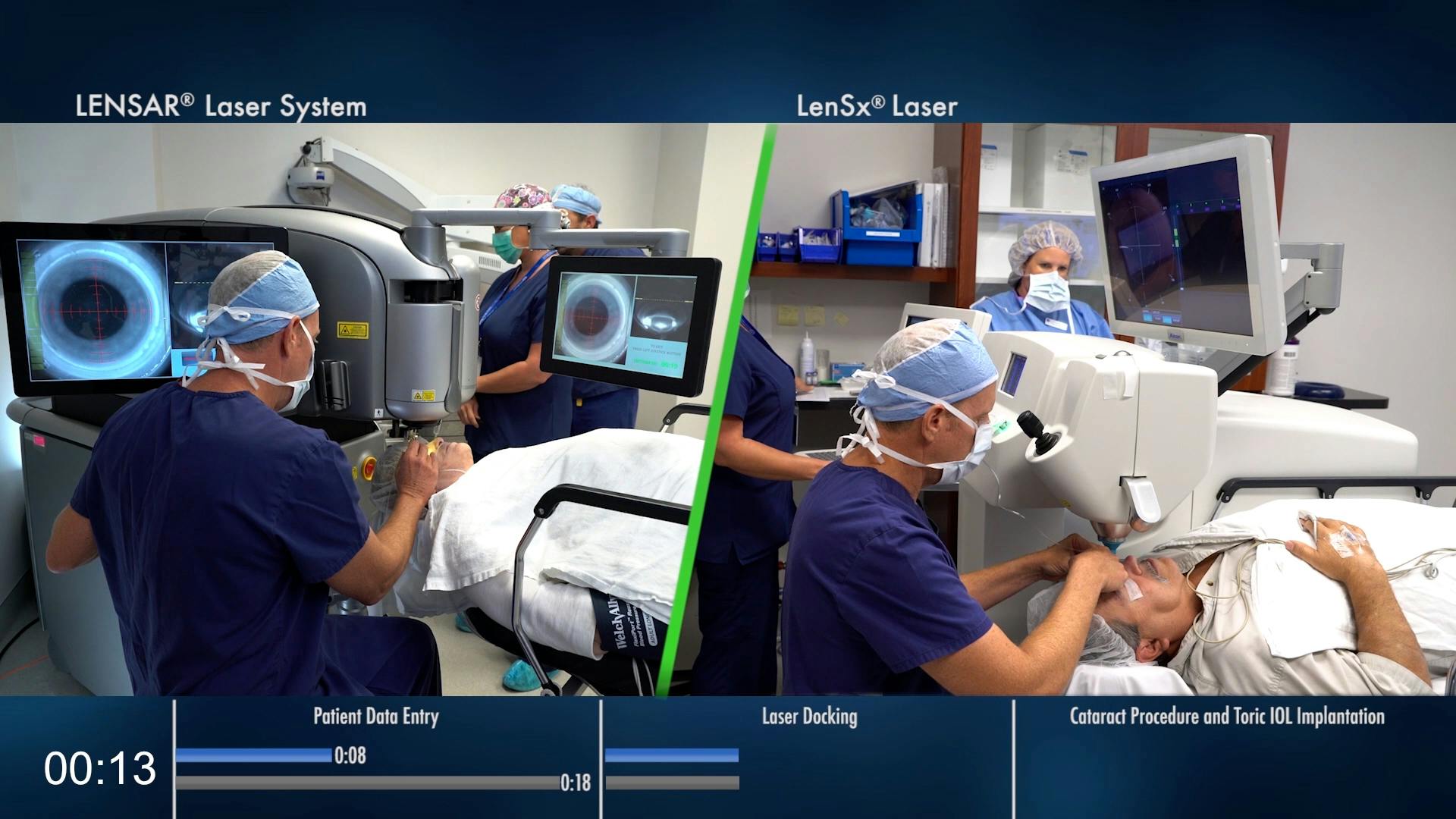 LENSAR Laser with Upgraded Streamline IV Software - Eyetube