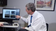 Easily Follow Patient Progression Utilizing Tools Available Within SPECTRALIS