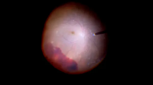 Chandelier Light thumbnail