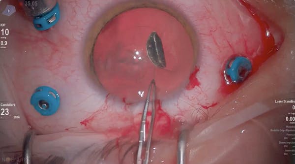 Trauma thumbnail