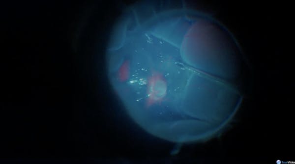 Wed AMD thumbnail