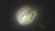 Macular Fold