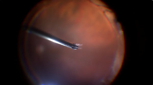 Silicone Tip thumbnail