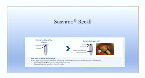 PDS Recall and Refill Exchange Procedure