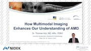 How Multimodal Imaging Enhances Our Understanding of AMD