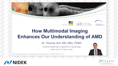 How Multimodal Imaging Enhances Our Understanding of AMD