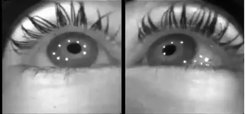 New Study Suggests Indoor Visual Habits May Be Driving Global Myopia Surge