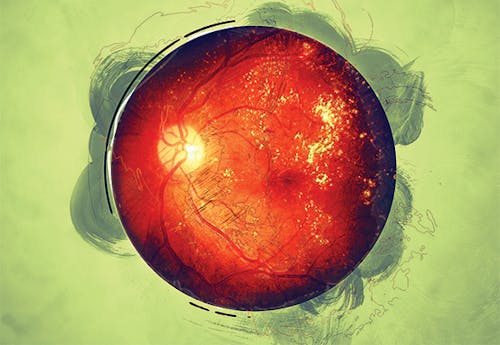 Dealing With Diabetes image