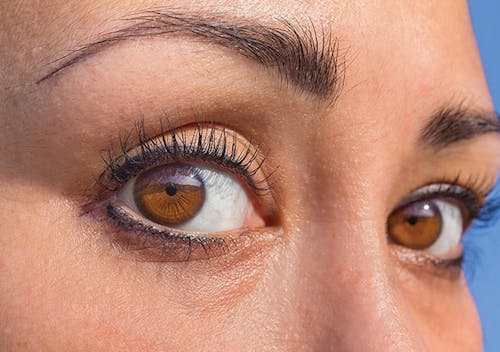 Cancer Treatment and the Eyes image