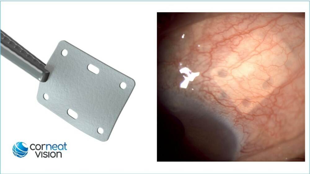 【裁断済み】外傷形成外科 Emergency Plastic Surgery Investigation of the Medium- and Long-Term Results of a
