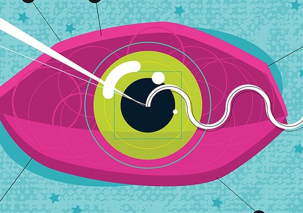 Corneal Dystrophies 101 - Modern Optometry