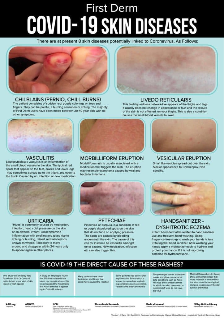 Covid 19 SKIN DISEASES by First Derm 1 724x1024 1 1594314187