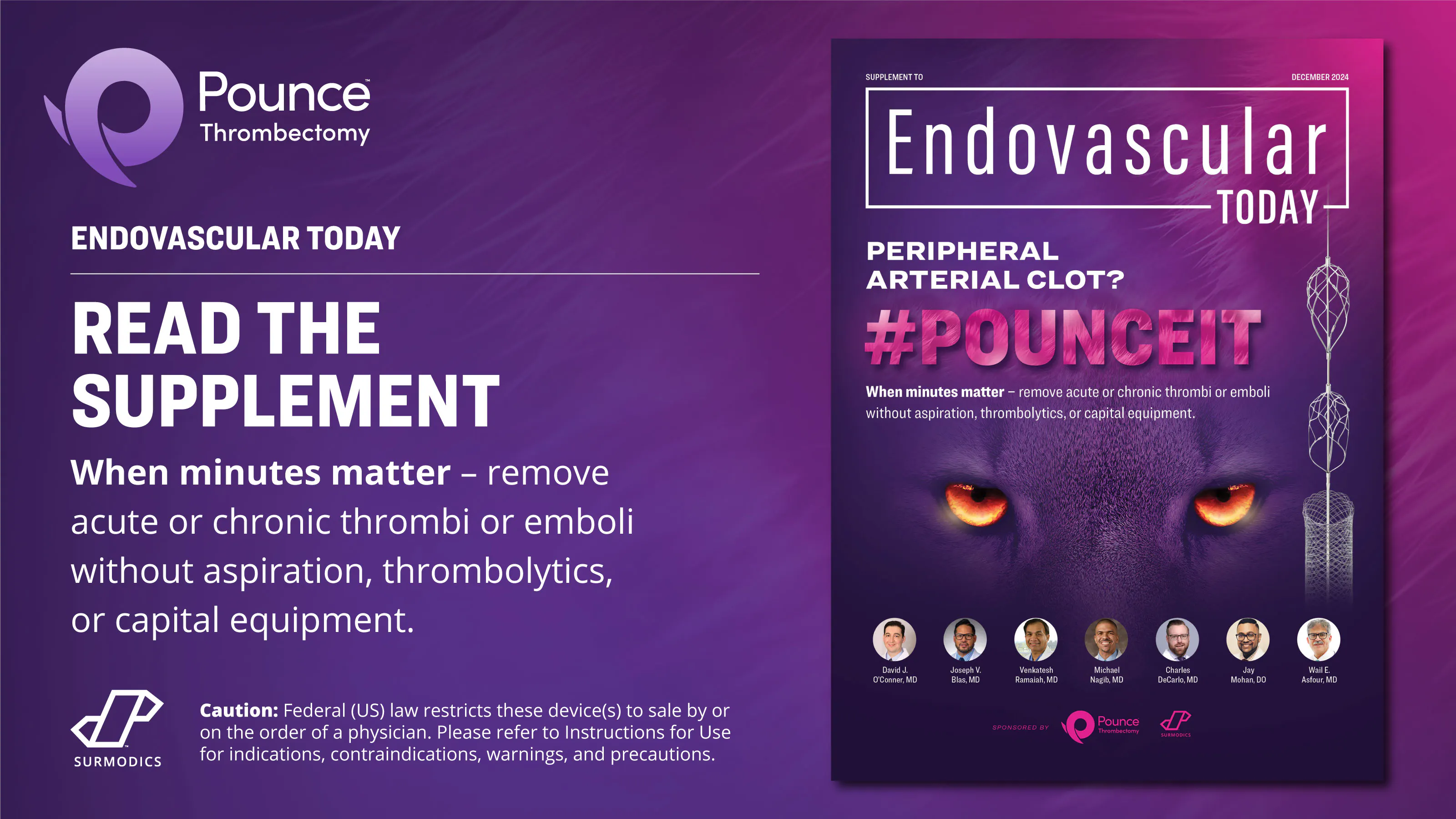 Case Report: Removal of Multifocal Organized Thrombi Using the Pounce ...