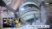 Refractive Considerations in a Glaucomatous Eye