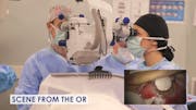 Trabeculectomy Pearls From the Moran Eye Center