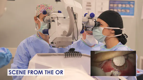 Trabeculectomy Pearls From the Moran Eye Center thumbnail