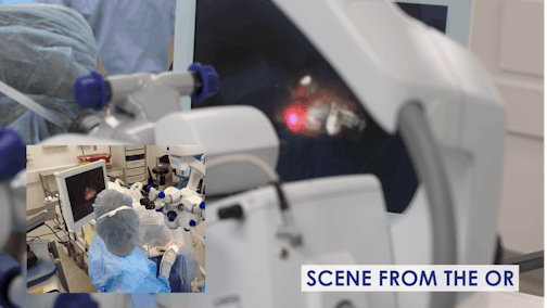 Endoscopic Cyclophotocoagulation in a Challenging Case of Neovascular Glaucoma