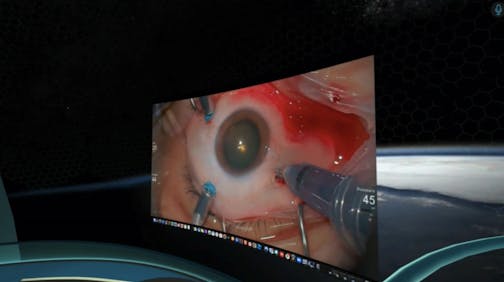 Retina Surgery in the Metaverse