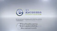 National Eczema Association: The Real Eczema thumbnail