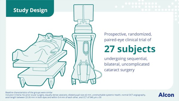 Phacoemulsification With an Active Fluidics System thumbnail