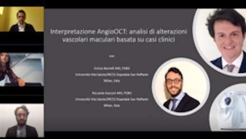 Interpretazione AngioOCT: analisi di alterazioni vascolari maculari basata su casi clinici