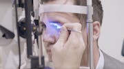 Kim Corneal Sweep: From Ideation to Practice