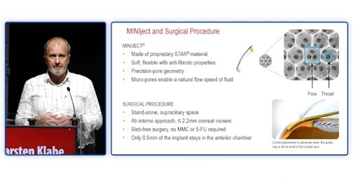 Patient Selection With MINIject: Who Can Benefit From Supraciliary MIGS?