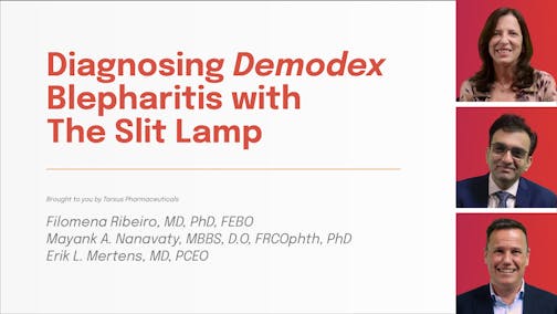 Diagnosing Demodex Blepharitis with the Slit Lamp