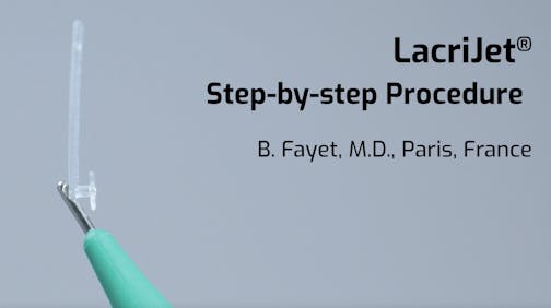 LacriJet<sup>®</sup> | Preloaded & Self-Retaining Monocanalicular Nasolacrimal Intubation