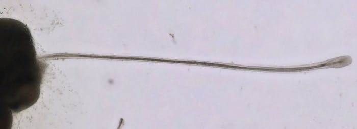 Potential Hair Growth Breakthrough: Researchers Grow Mature Hair Follicles in Lab - Practical Dermatology Potential Hair Growth Breakthrough: Researchers Grow Mature Hair Follicles in Lab - Practical Dermatology