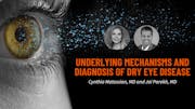 Underlying Mechanisms and Diagnosis of Dry Eye Disease